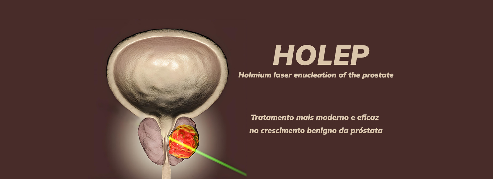 Banner Banner HOLEP