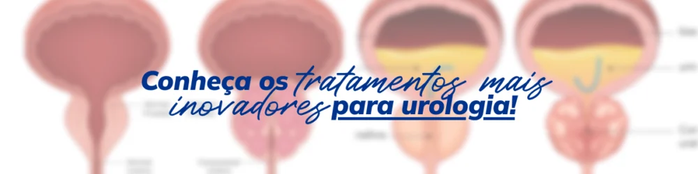 Tratamento para falta de ereção em Manaus: conheça as alternativas disponíveis para recuperar a função sexual